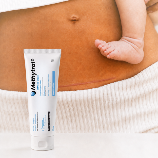 Methytral Esthetic Cream 50gm