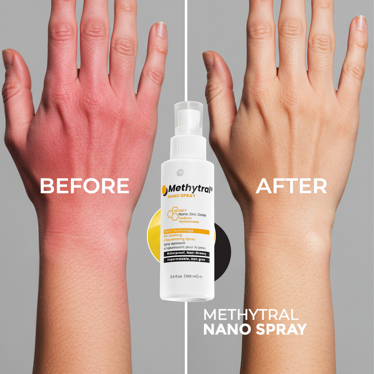 Methytral Nano Spray 100ml